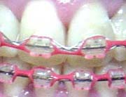 tooth7wire