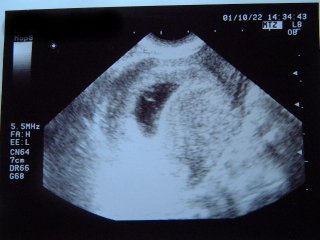妊娠初期 ０ヶ月 ４ヶ月 Happy Mamako 楽天ブログ